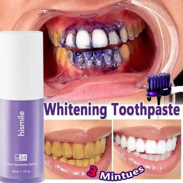 deal-pack-of-2-teeth-brightening-hismiles-v34-colour-corrector-serum-micro-nano-tooth-brush-for-sensitive-gums-toothbrush - 2.webp