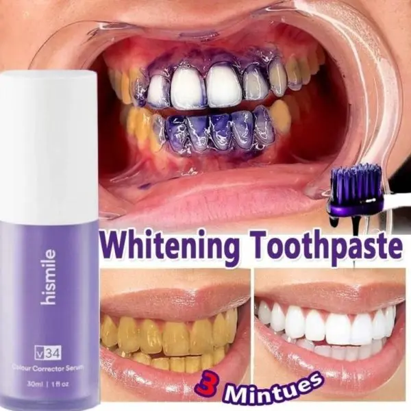 deal-pack-of-2-teeth-brightening-hismiles-v34-colour-corrector-serum-micro-nano-tooth-brush-for-sensitive-gums-toothbrush - 5.webp