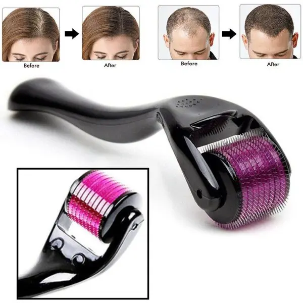 derma-roller-0-5mm-with-540-micro-needle-for-hair-growth-and-facial-skin-therapy-skin-care-beauty-tool-for-anti-aging-skin-repair-anti-wrinkles-stretch-and-acne-scars-removal-for-men-and-women - 2.webp